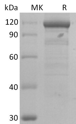 Human IL-8 (C-6His) Protein