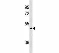 Anti-AKT1S1, clone 449CT13.4.2