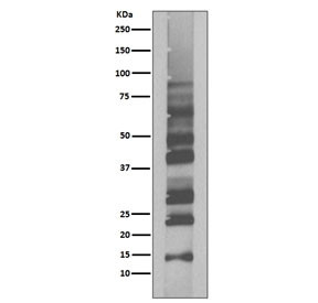 Anti-Ubiquitin / K63-Linkage Specific, clone IGC-21