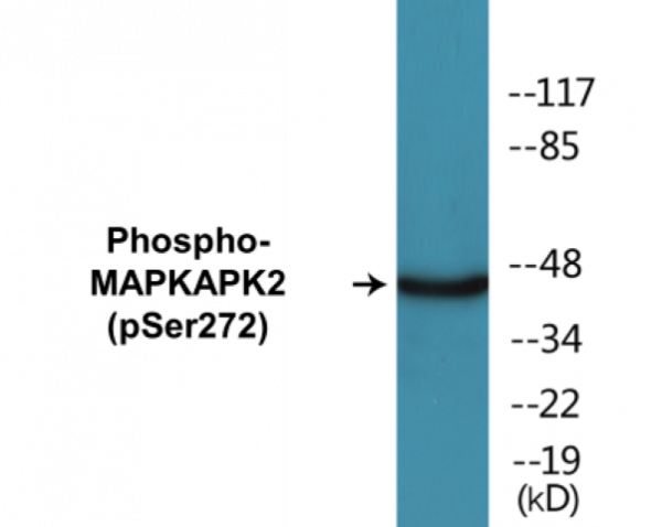 MAPKAPK2 (Phospho-Ser272) Colorimetric Cell-Based ELISA Kit