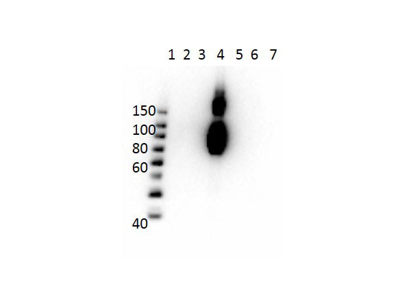 Anti-Hemoglobin beta C, clone 15C2.C11.F2.G1