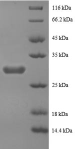 Peptide YY protein (PYY), partial, human, recombinant