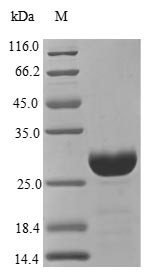 Cathepsin S (CTSS), human, recombinant