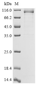 DNA polymerase theta (POLQ), partial, human, recombinant