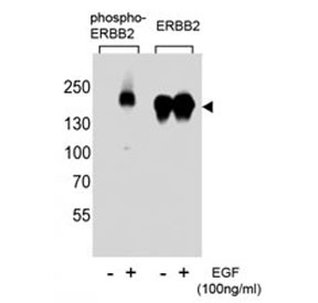 Anti-phospho-ErbB2 (Tyr1221)
