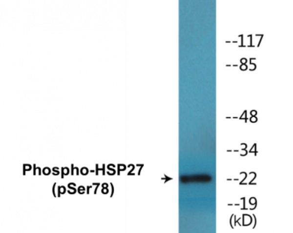 HSP27 (Phospho-Ser78) Colorimetric Cell-Based ELISA Kit