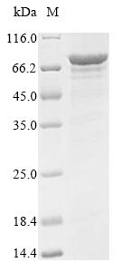 Probable ATP-dependent RNA helicase DDX5 (DDX5), human, recombinant