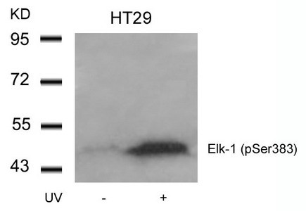 Anti-Phospho-ELK1 (Ser383)