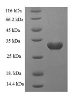 Sortilin (Sort1), partial, rat, recombinant