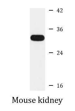 Anti-Cathepsin G