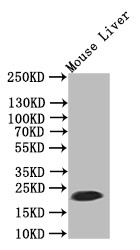 Anti-FTH1 Recombinant Monoclonal, clone 39G3