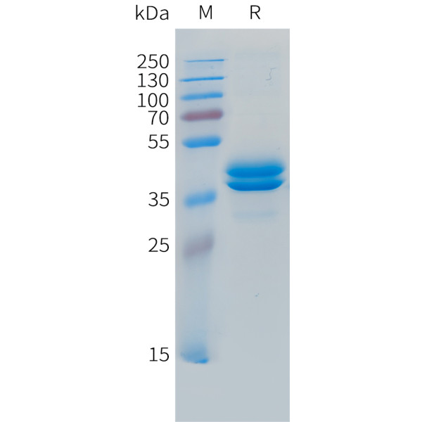 Human CCL7 Protein, hFc Tag