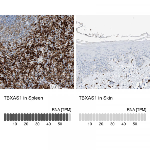 Anti-TBXAS1