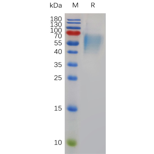 Mouse IL17RA Protein, His Tag