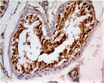 Anti-IDH1 (Clone: ABM44B3)