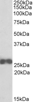 Anti-ARHGDIB, N-terminal