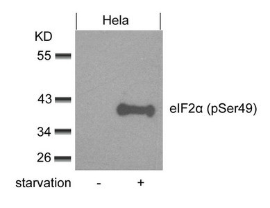 Anti-Phospho-EIF2S1 (Ser49)