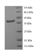 Signal transducer and activator of transcription 3 (STAT3), partial, human, recombinant