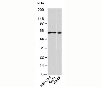 Anti-HSP60