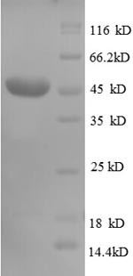 CD320 antigen (CD320), partial, human, recombinant