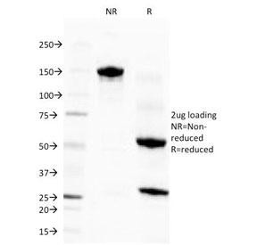 Anti-Eosinophil Peroxidase, clone EPO104