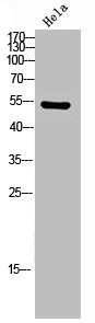 Anti-Phospho-CAMK2A/CAMK2D (T286)