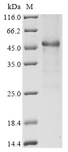 Interleukin-2 receptor subunit alpha (IL2RA), partial, human, recombinant