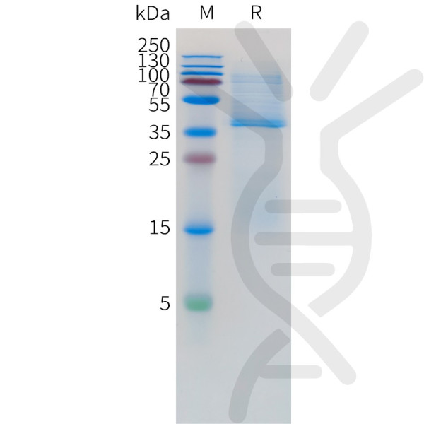 Human CD3D Protein, His Tag and Human CD3E Protein, hFc Tag