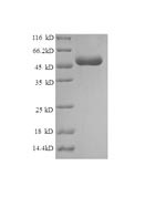 Histone H1.1 (H1-1), mouse, recombinant