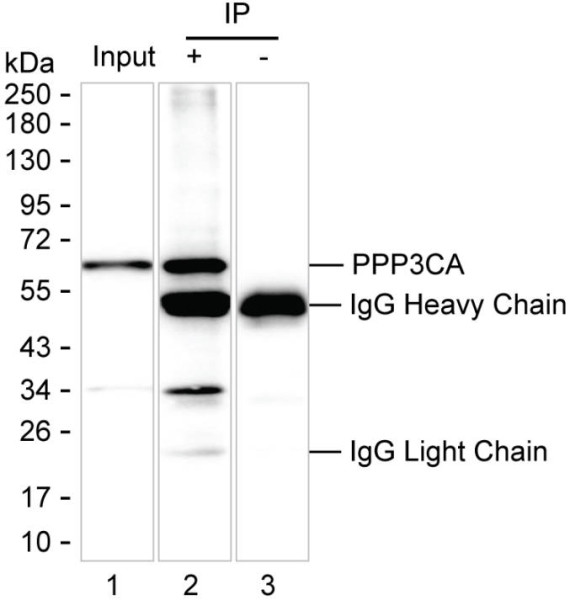 Anti-PPP3CA Recombinant