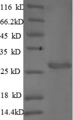 Cathepsin S (Ctss), mouse, recombinant