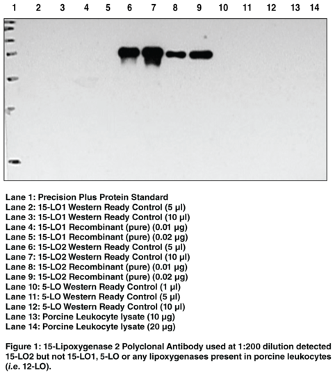 Anti-15-Lipoxygenase-2