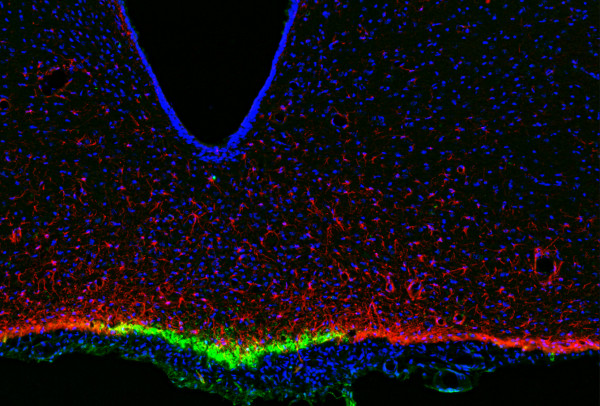 Anti-IFN-gamma