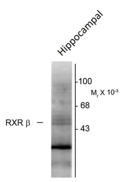 Anti-Retinoid X Receptor beta, clone 147