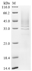 Cathepsin B (CTSB), human, recombinant