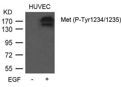 Anti-Phospho-MET (Tyr1234/1235)