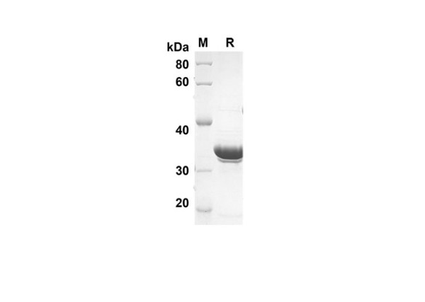 G-CSF Protein (Trx Tag) (recombinant human)