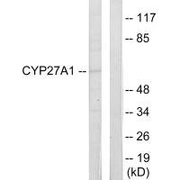 Anti-CYP27A1