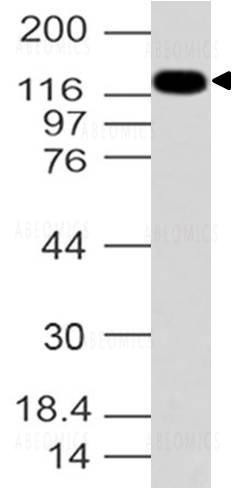 Anti-Formin-like protein 2