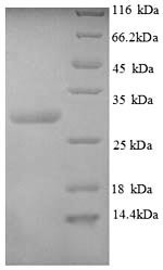 Calcitonin gene-related peptide 1 (CALCA), partial, human, recombinant