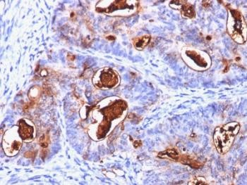 Anti-CEA (Carcinoembryonic Antigen), clone C66/1260