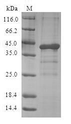 Appetite-regulating hormone (GHRL), human, recombinant