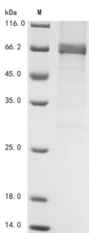 5-AMP-activated protein kinase catalytic subunit alpha-1 (Prkaa1), mouse, recombinant
