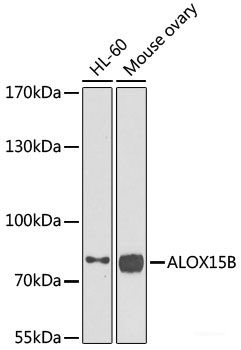 Anti-ALOX15B