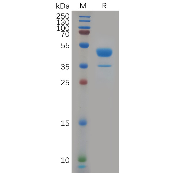Human CXCR2 Protein, hFc Tag