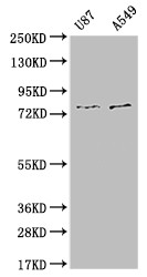 Anti-SLC25A12 Recombinant Monoclonal, clone 10B12