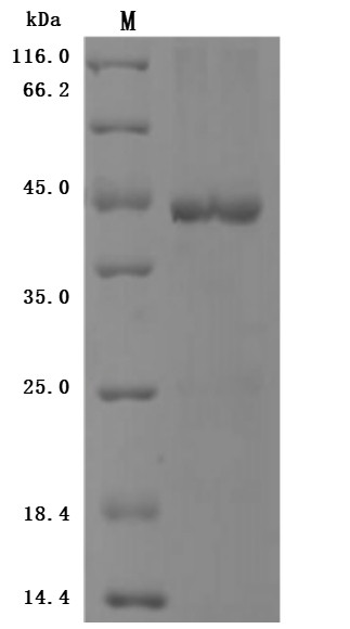 Bromodomain-containing protein 4 (BRD4), partial, human, recombinant