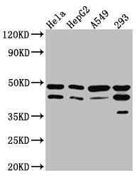 Anti-GSK3B Recombinant Monoclonal, clone 9G11