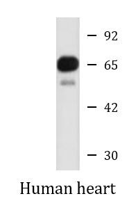 Anti-SLC22A8