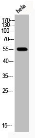 Anti-Phospho-AKT1/AKT2/AKT3 (T308)